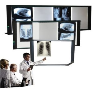 NEGATOSCOPE EXTRA-PLAT (1,2,3, OU 4 PLAGES)